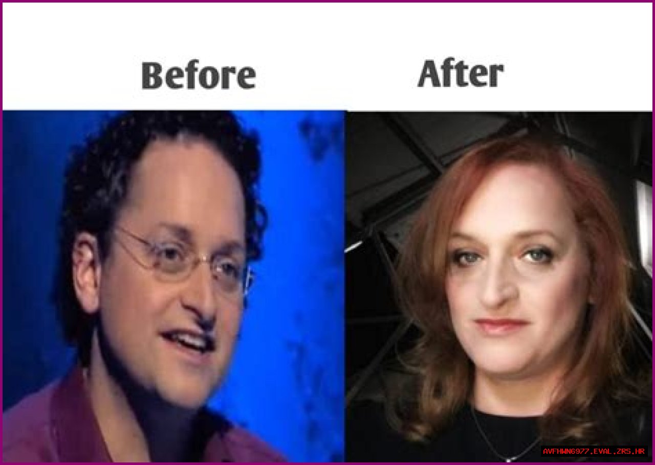 Dr. Lynette Nusbacher Before And After: A Journey Of Transformation