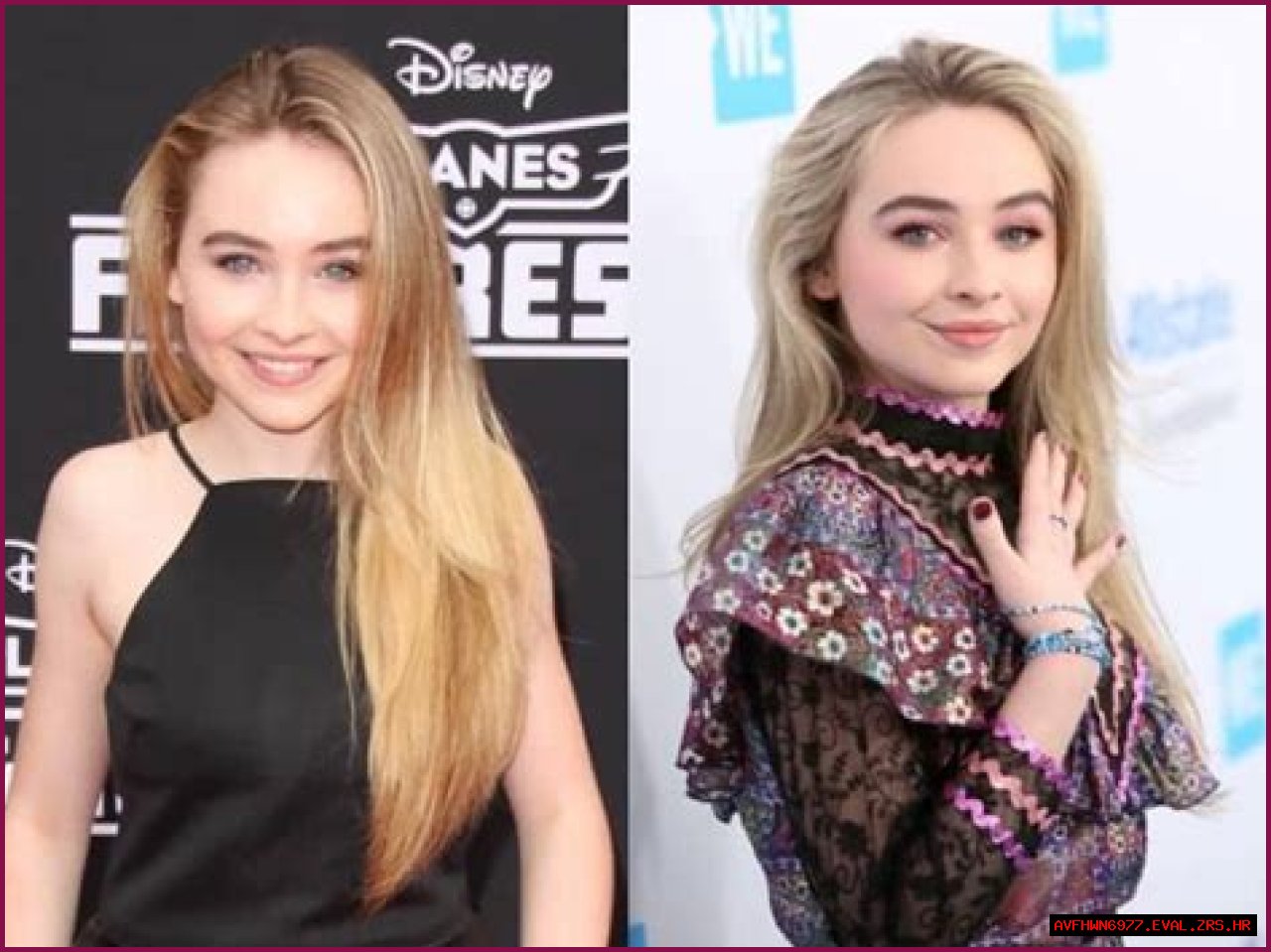 Exploring The Truth: Did Sabrina Carpenter Get A Nose Job?