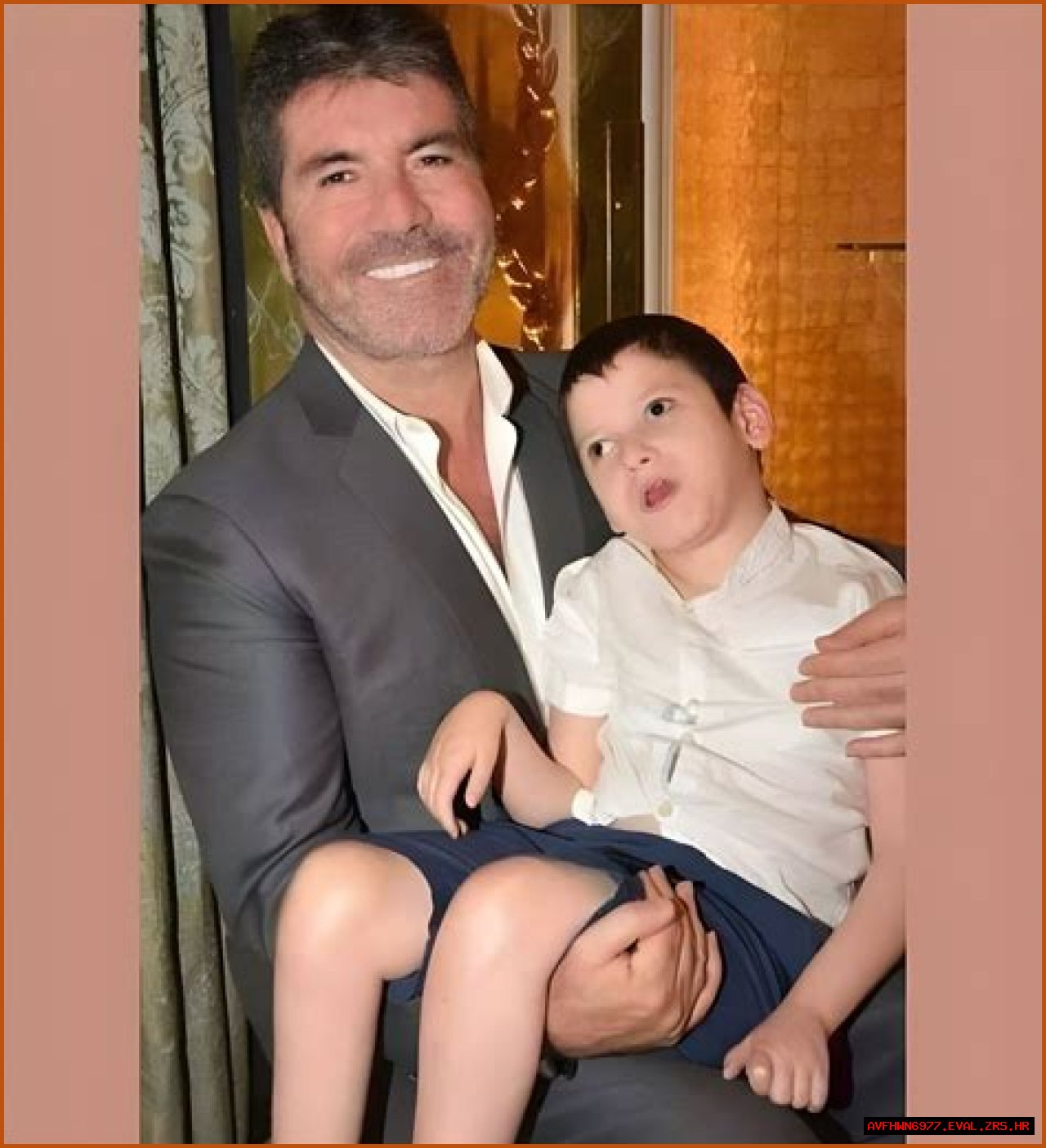 Understanding Simon Cowell's Son Health Condition: A Deep Dive