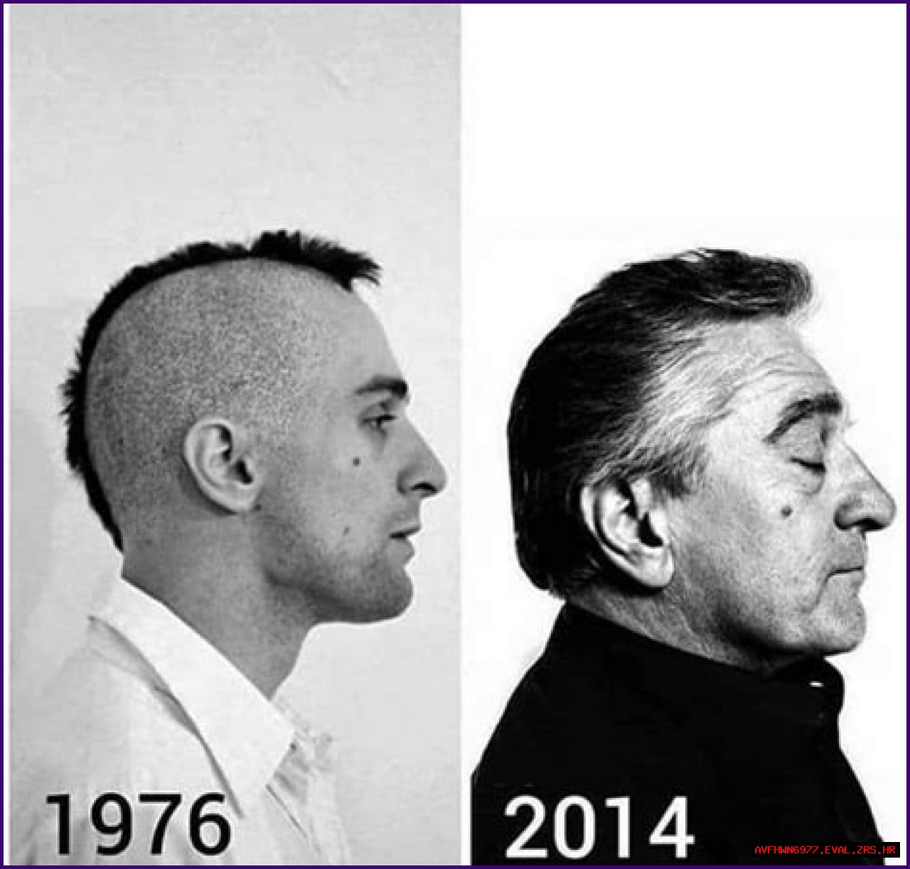 Understanding The De Niro Ear: A Comprehensive Guide