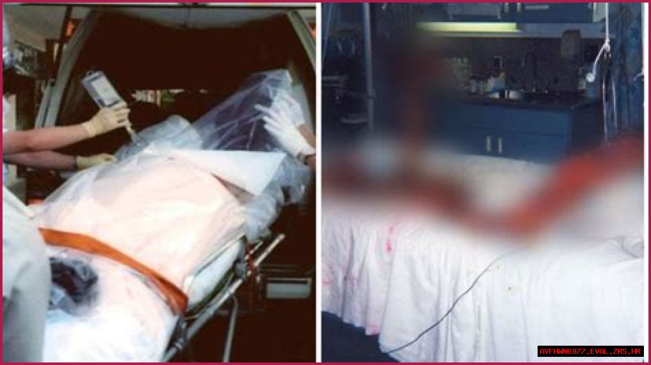 Unraveling The Mystery Behind Hisashi Ouchi Photo