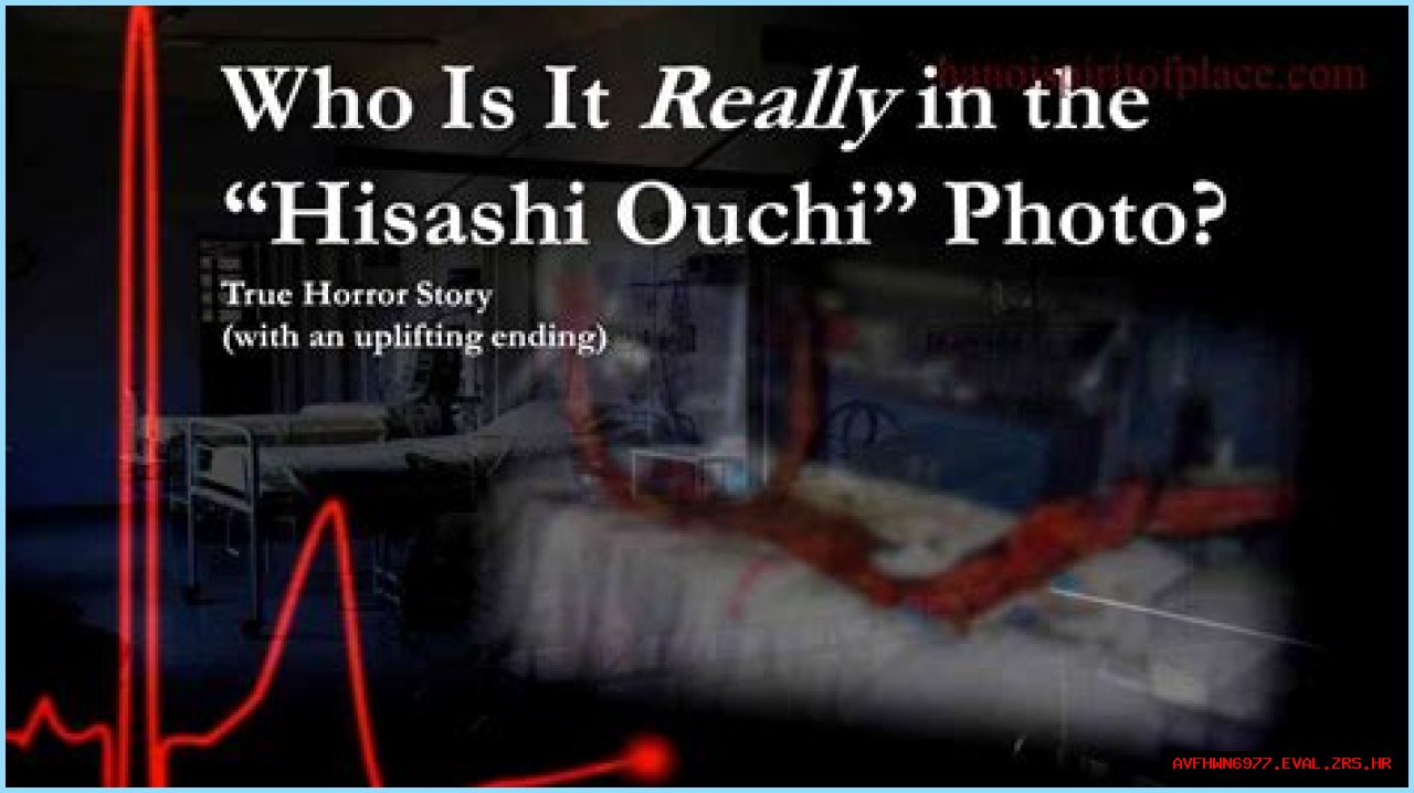 Unraveling The Mystery Of Hisashi Ouchi's Real Body